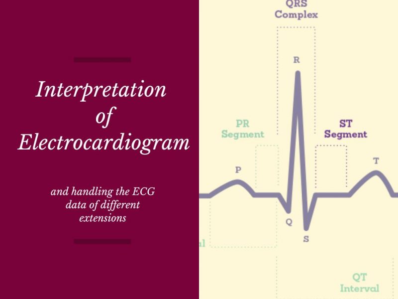 Interpretation of ECG