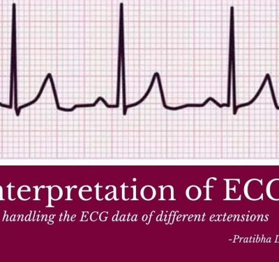 Interpretation-ECG