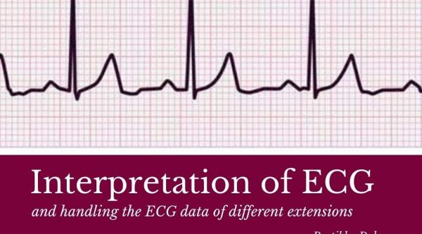 Interpretation-ECG
